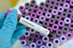 non-tutti-i-mali-vengono-per-nuocere----coronavirus-2.jpg